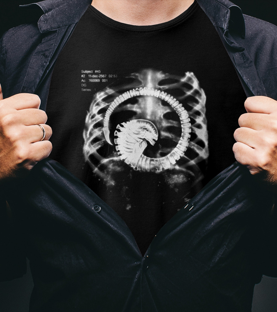 Subject #45 11-Dec-2567 X-Ray Alien Its A Baby Mirthcorp Series DG T-Shirt