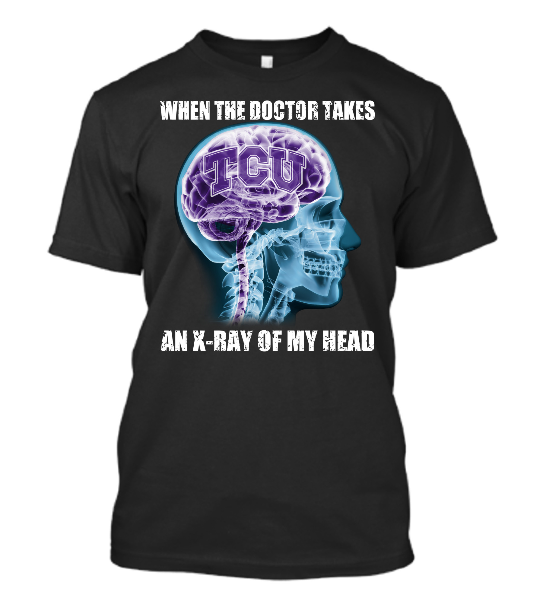 TCU Horned Frogs When The Doctor Takes An X-ray Of My Head T-Shirt