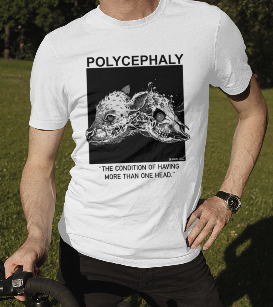 Polycephaly The Condition Of Having More Than One Head T-Shirt
