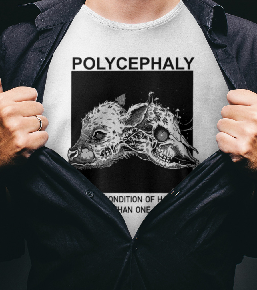 Polycephaly The Condition Of Having More Than One Head T-Shirt