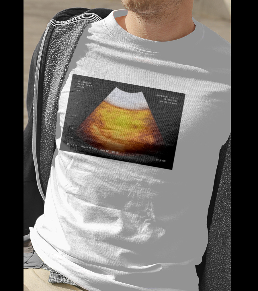 Beer Ultrasound Image Not Safe For Liver T-Shirt
