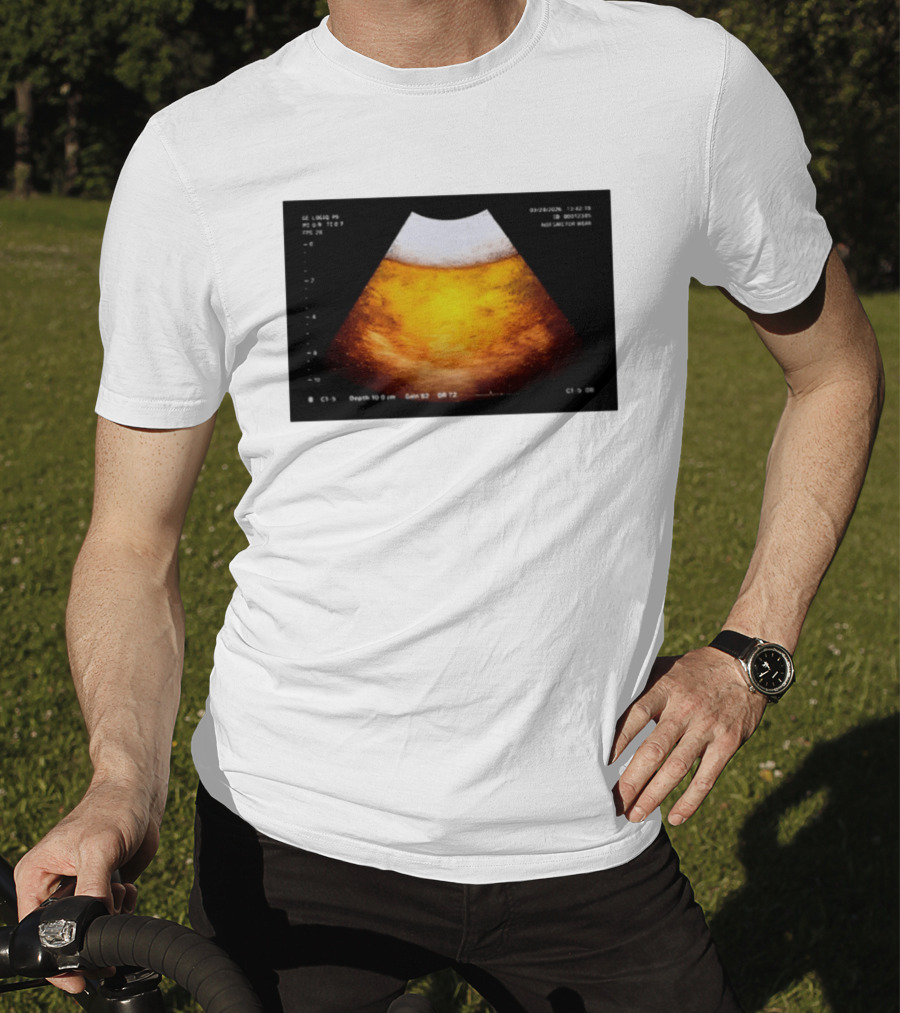 Beer Ultrasound Image Not Safe For Liver T-Shirt