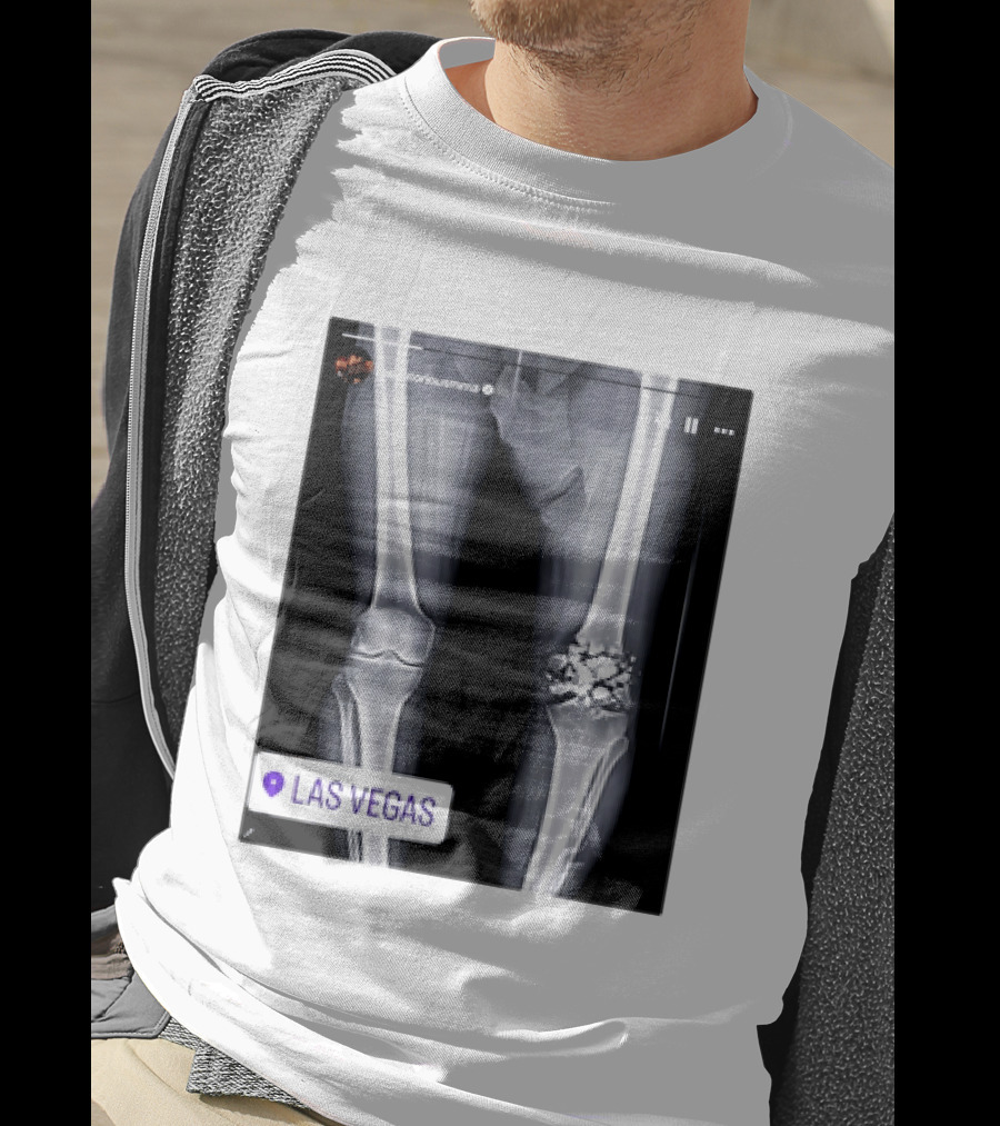 Conor McGregor X Ray Broken Knee Las Vegas T-Shirt