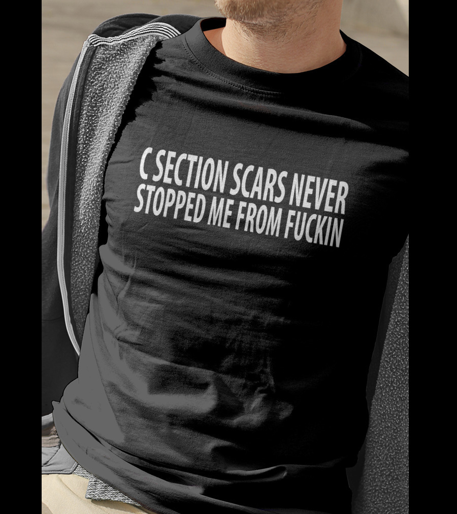 Reginald C Section Scars Never Stopped Me From Fuckin T-Shirt