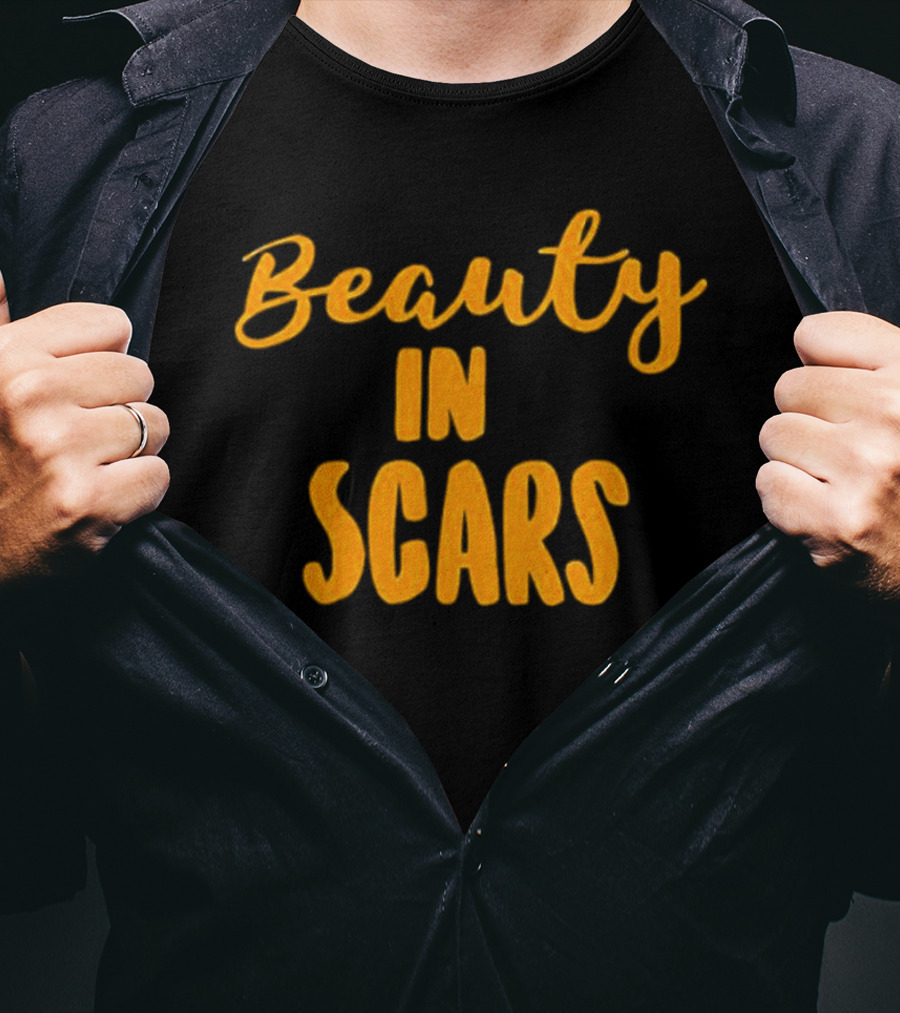 Beauty In Scars Kechi T-Shirt